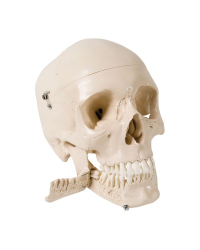 Skull Model with Teeth for Extraction, 4 part